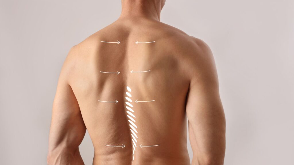 Anatomia de la columna vertebral